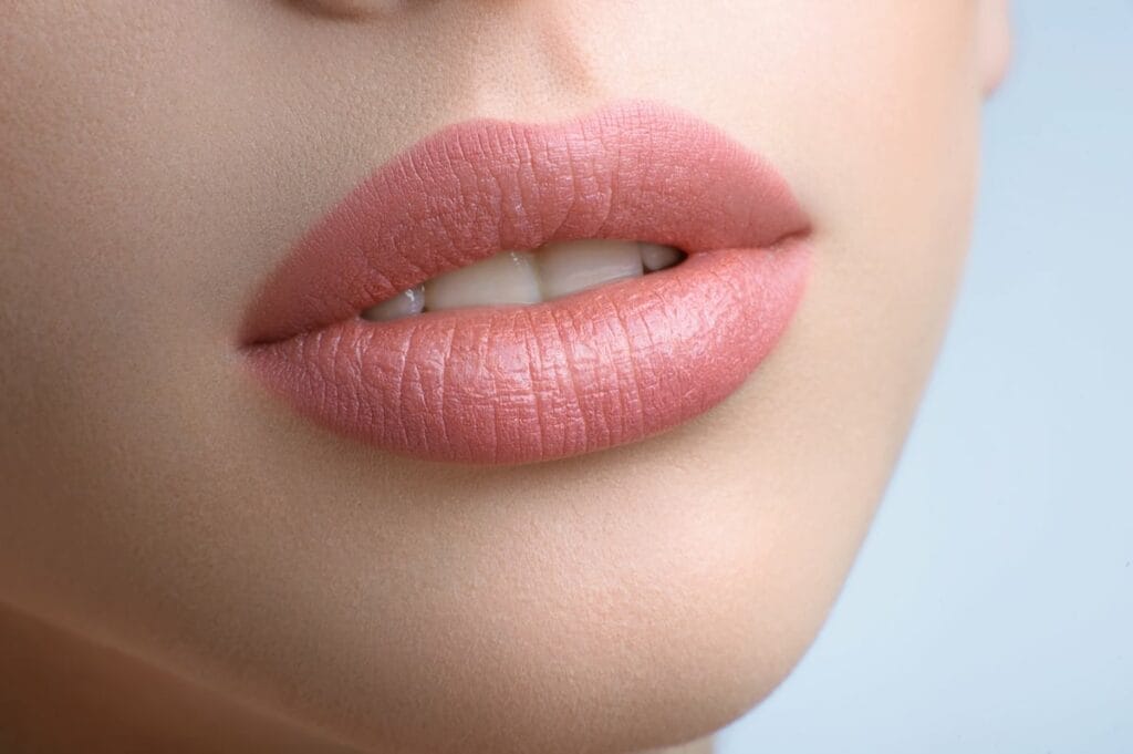 Russian lip augmentation