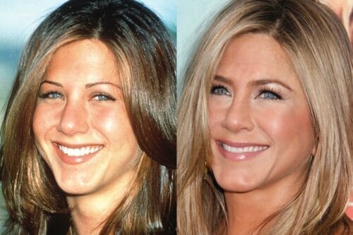 Jennifer Aniston