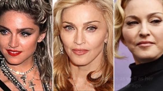 Madonna Before and After