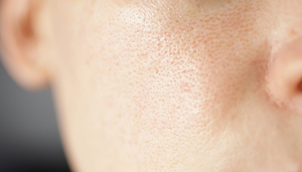 What Is Pore